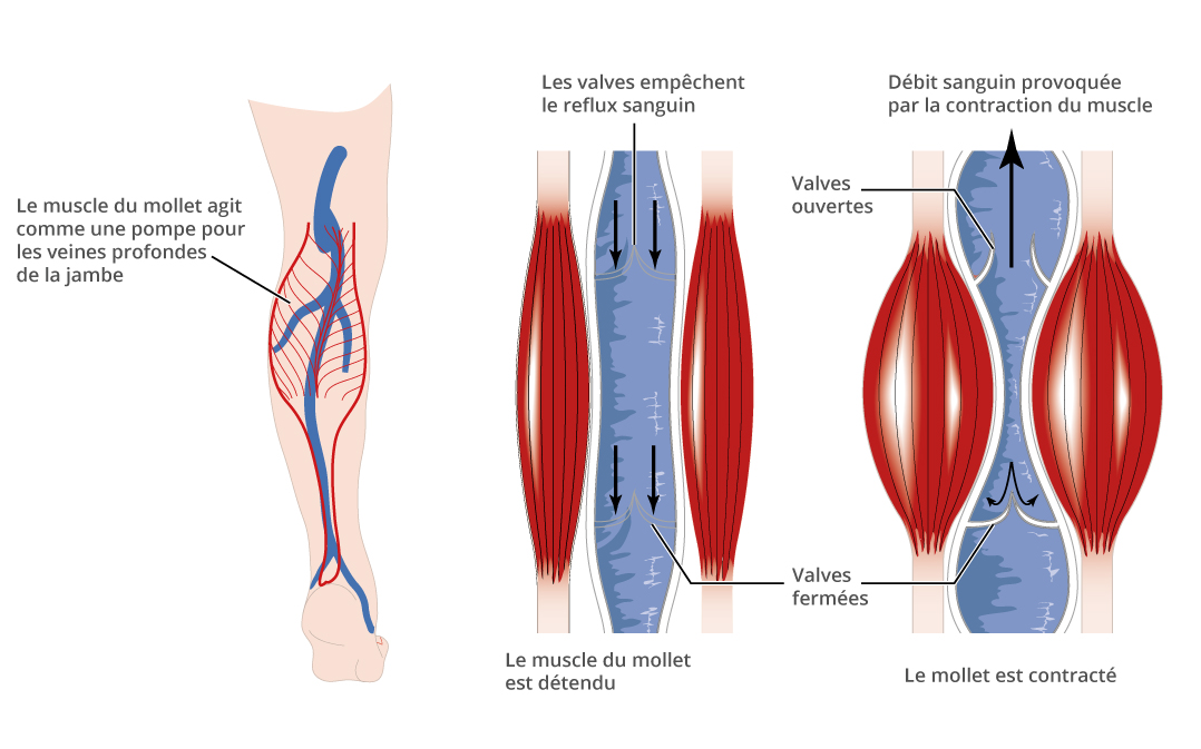 pompe-musculaire-mollet-1