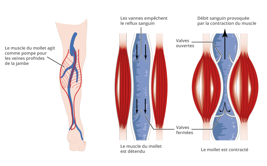 pompe-musculaire-mollet